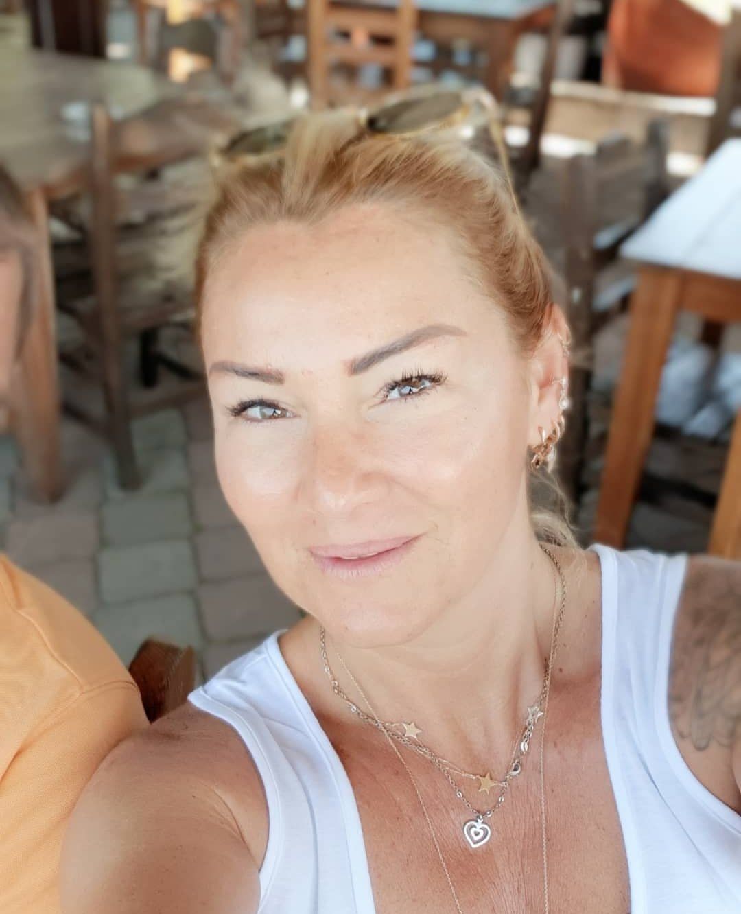 Botoks yaptıran ünlülerin son hali herkesi şoke ediyor!